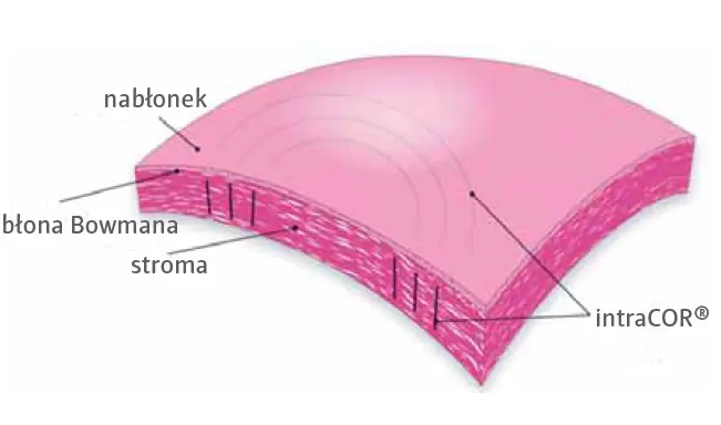 stroma